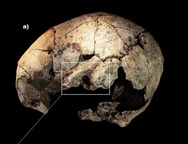 Sensacyjne odkrycie archeologów. Czaszka sprzed ponad 5000 lat miała ślady operacji ucha